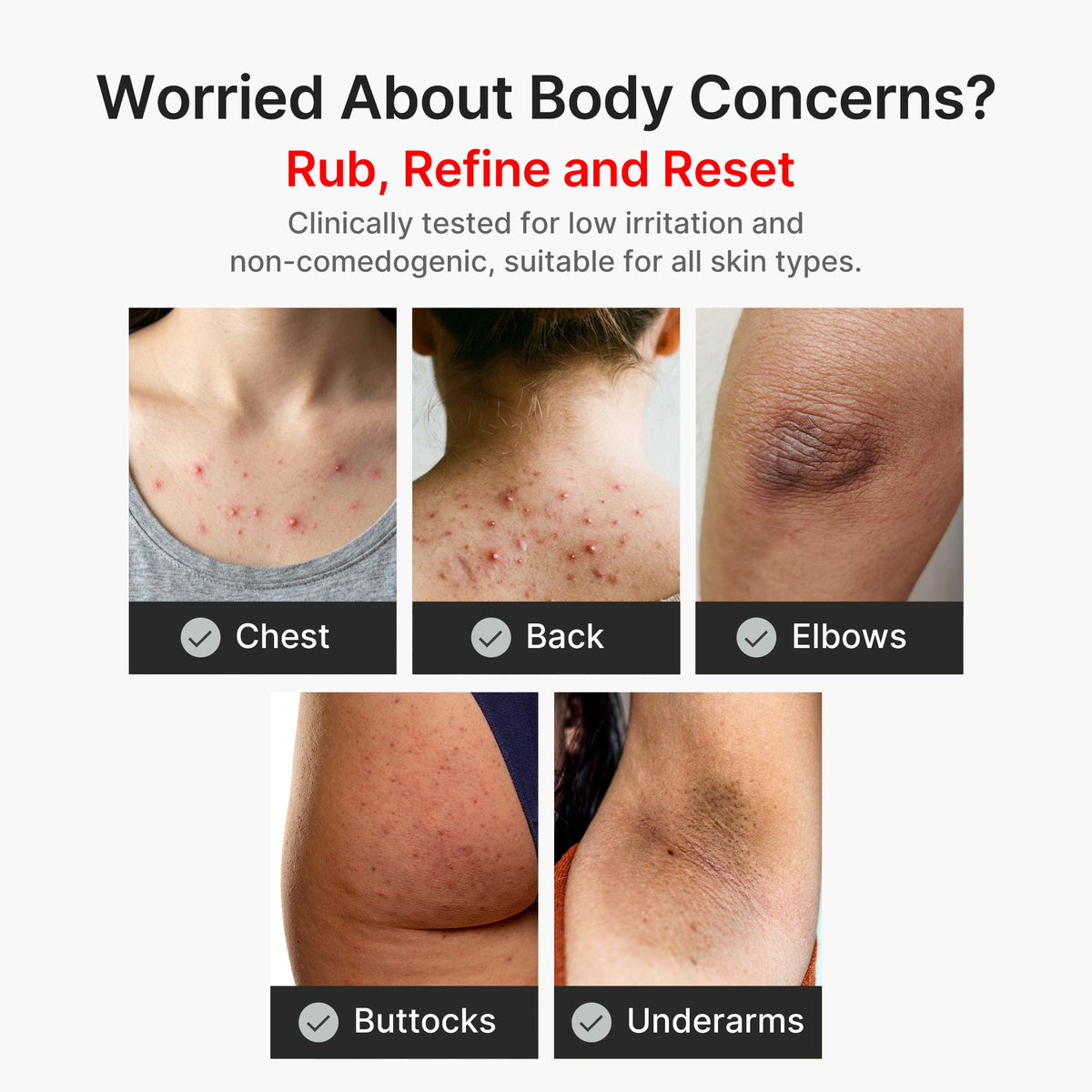 [Exclusive Deal] Amazon’s #1 Beauty Brand |  Kojic Acid Turmeric Body Peel Shot