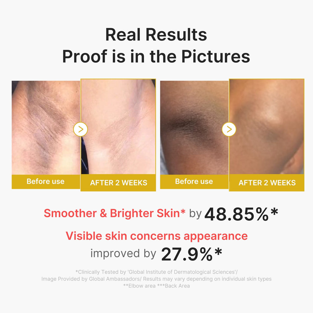 [Exclusive Deal] Amazon’s #1 Beauty Brand |  Kojic Acid Turmeric Body Peel Shot