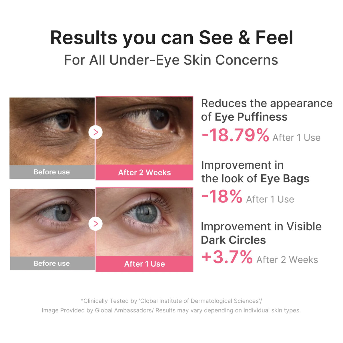 [Exclusive Deal] Amazon’s #1 Beauty Brand |  PDRN Caffeine Collagen Eye Patch