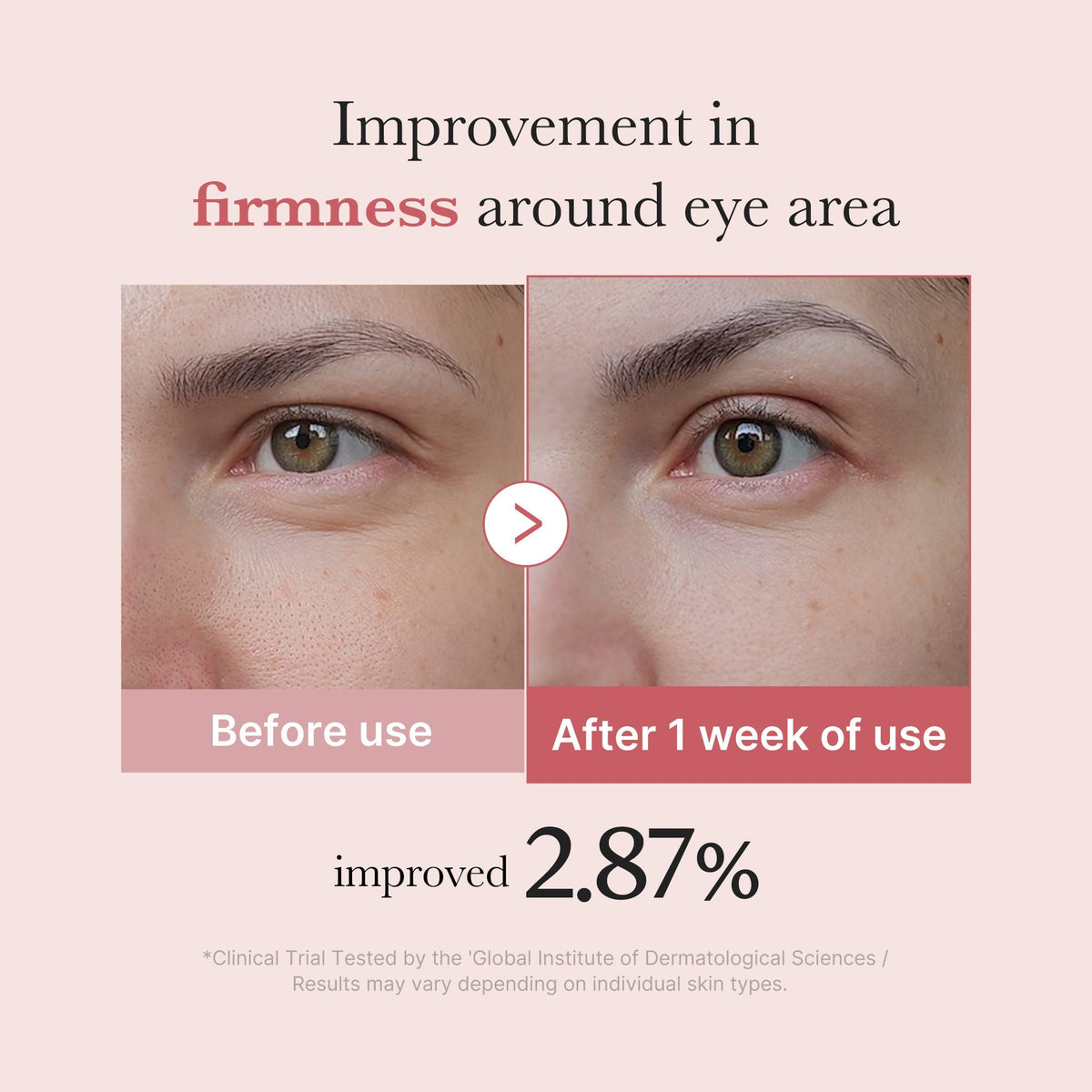 [Exclusive Deal] Amazon’s #1 Beauty Brand |  PDRN Pink Peptide Eye Cream