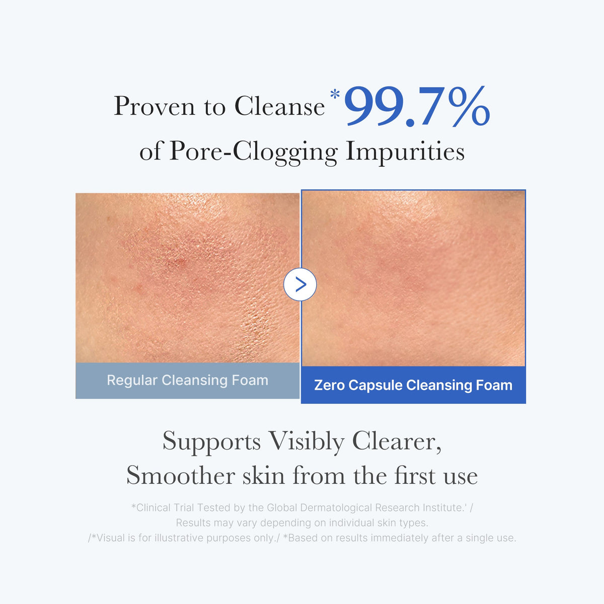 [Exclusive Deal] Amazon’s #1 Beauty Brand |  Zero Pore Capsule Cleansing Foam