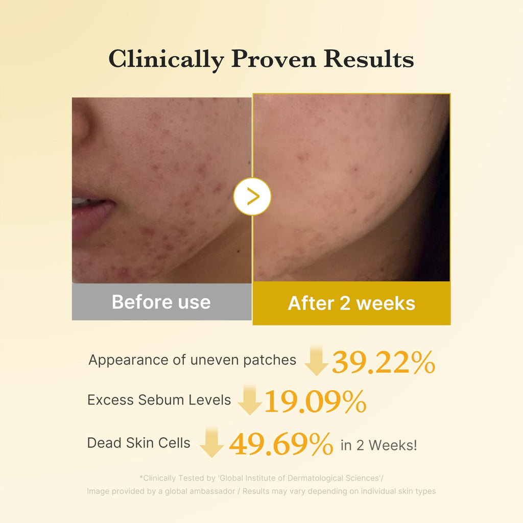 [GIFT] Kojic Acid Turmeric Toner Pad