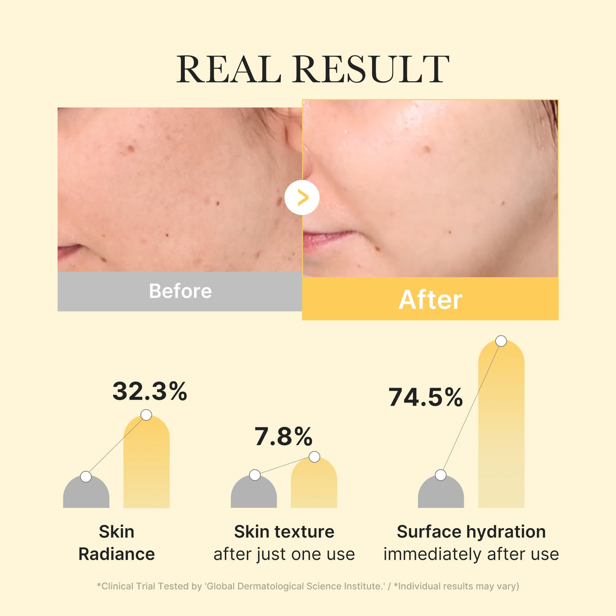 Kojic Acid Turmeric Gold Jelly Gel Mask