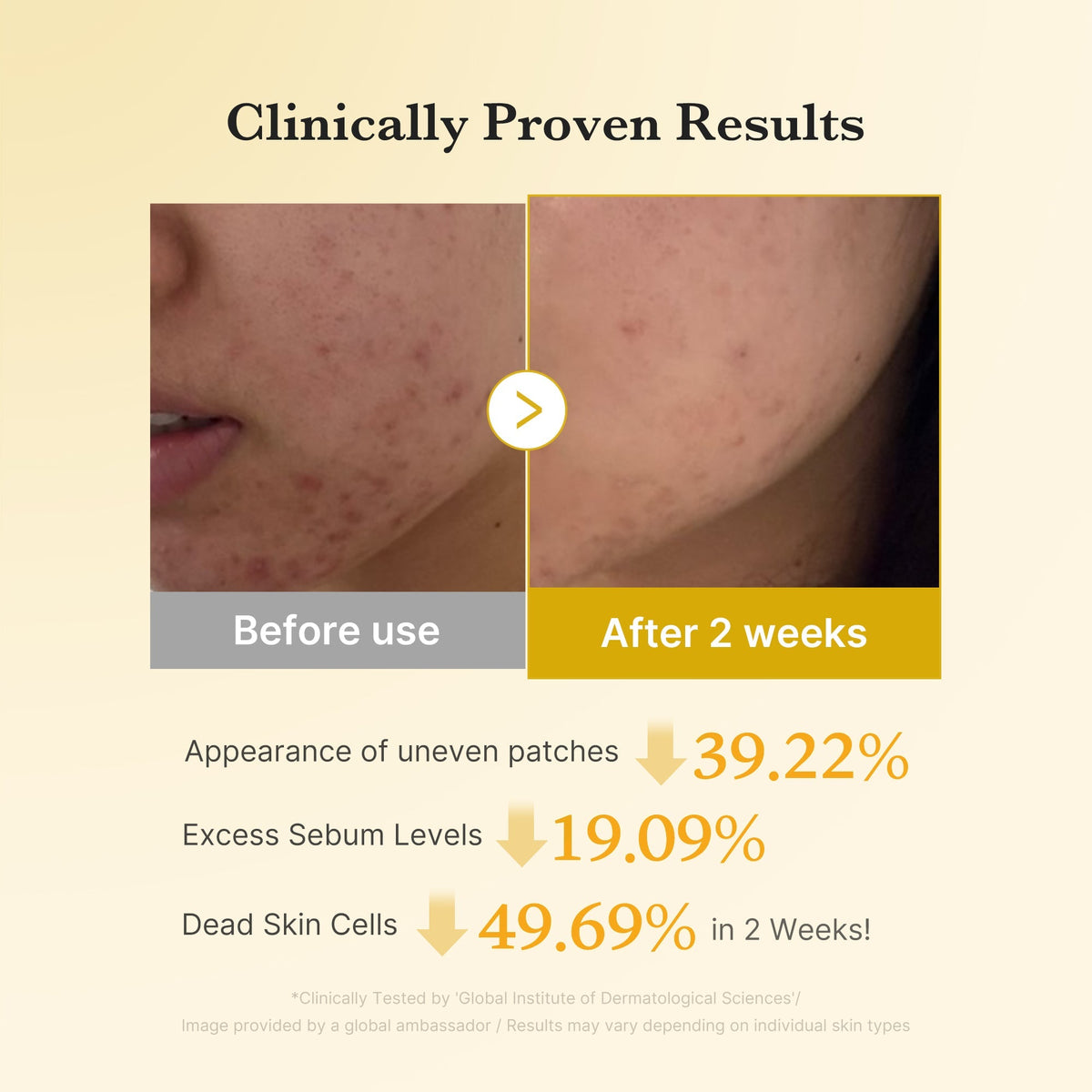[Subscr.] Kojic Acid Turmeric Toner Pad